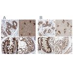 ZC3H15 Antibody in Immunohistochemistry (IHC)