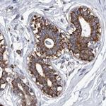 ZC3H15 Antibody in Immunohistochemistry (IHC)