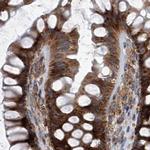 ZC3H15 Antibody in Immunohistochemistry (IHC)