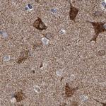 ZC3H15 Antibody in Immunohistochemistry (IHC)