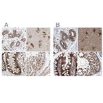 ZC3H15 Antibody in Immunohistochemistry (IHC)