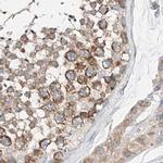 ZC3H15 Antibody in Immunohistochemistry (IHC)