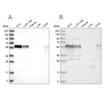 ZC3H15 Antibody in Western Blot (WB)