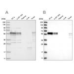 ZC3H15 Antibody in Western Blot (WB)