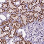 KMO Antibody in Immunohistochemistry (IHC)