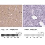 DNAJC6 Antibody in Immunohistochemistry (IHC)