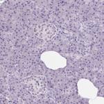 DNAJC6 Antibody in Immunohistochemistry (IHC)