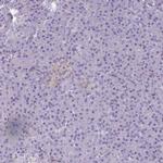 PDE2A Antibody in Immunohistochemistry (IHC)