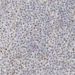 BYSL Antibody in Immunohistochemistry (IHC)