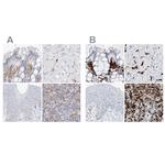 Thromboxane synthase Antibody in Immunohistochemistry (IHC)