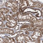 COQ3 Antibody in Immunohistochemistry (IHC)