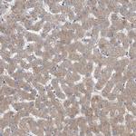 COQ3 Antibody in Immunohistochemistry (IHC)