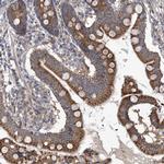 COQ3 Antibody in Immunohistochemistry (IHC)