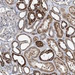 COQ3 Antibody in Immunohistochemistry (IHC)