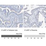 C1orf87 Antibody in Immunohistochemistry (IHC)