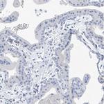 C1orf87 Antibody in Immunohistochemistry (IHC)