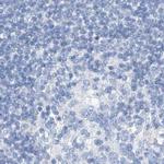 C1orf87 Antibody in Immunohistochemistry (IHC)