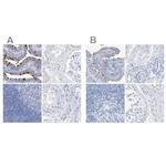 C1orf87 Antibody in Immunohistochemistry (IHC)