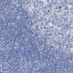 C1orf87 Antibody in Immunohistochemistry (IHC)