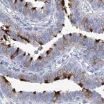 C1orf87 Antibody in Immunohistochemistry (IHC)