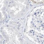 C1orf87 Antibody in Immunohistochemistry (IHC)