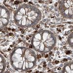 XTP3B Antibody in Immunohistochemistry (IHC)