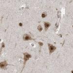 XTP3B Antibody in Immunohistochemistry (IHC)