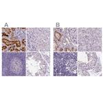 V-ATPase D Antibody in Immunohistochemistry (IHC)