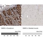 GMDS Antibody in Immunohistochemistry (IHC)