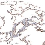 HAS3 Antibody in Immunohistochemistry (IHC)