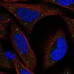 KCTD8 Antibody in Immunocytochemistry (ICC/IF)