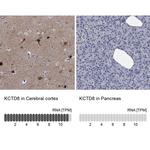 KCTD8 Antibody