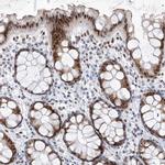 Atrophin 1 Antibody in Immunohistochemistry (IHC)