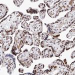 Atrophin 1 Antibody in Immunohistochemistry (IHC)