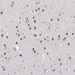 Atrophin 1 Antibody in Immunohistochemistry (IHC)