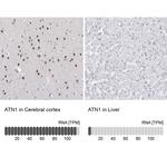 Atrophin 1 Antibody