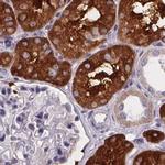 PAH Antibody in Immunohistochemistry (IHC)