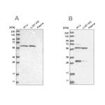 PAH Antibody in Western Blot (WB)