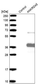 ANKRD45 Antibody in Western Blot (WB)