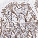 PPA2 Antibody in Immunohistochemistry (IHC)