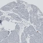 RSPH9 Antibody in Immunohistochemistry (IHC)