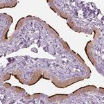 RSPH9 Antibody in Immunohistochemistry (IHC)