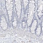 PGC Antibody in Immunohistochemistry (IHC)