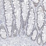 PGC Antibody in Immunohistochemistry (IHC)