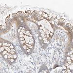 ZZEF1 Antibody in Immunohistochemistry (IHC)