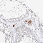 ZZEF1 Antibody in Immunohistochemistry (IHC)