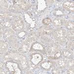 ZZEF1 Antibody in Immunohistochemistry (IHC)