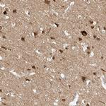 REEP2 Antibody in Immunohistochemistry (IHC)