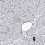 REEP2 Antibody in Immunohistochemistry (IHC)