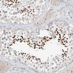 C2orf42 Antibody in Immunohistochemistry (IHC)